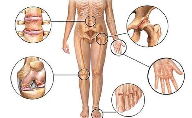 komplikacije bol u zglobovima